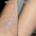 Siero Anti-Ricrescita